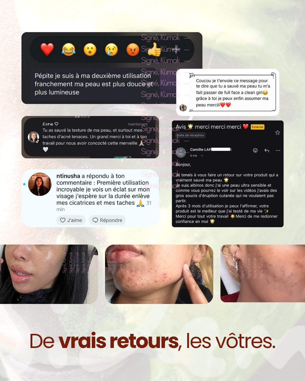 Retours de clientes sur SIDEM, messages et photos de peau sans retouche