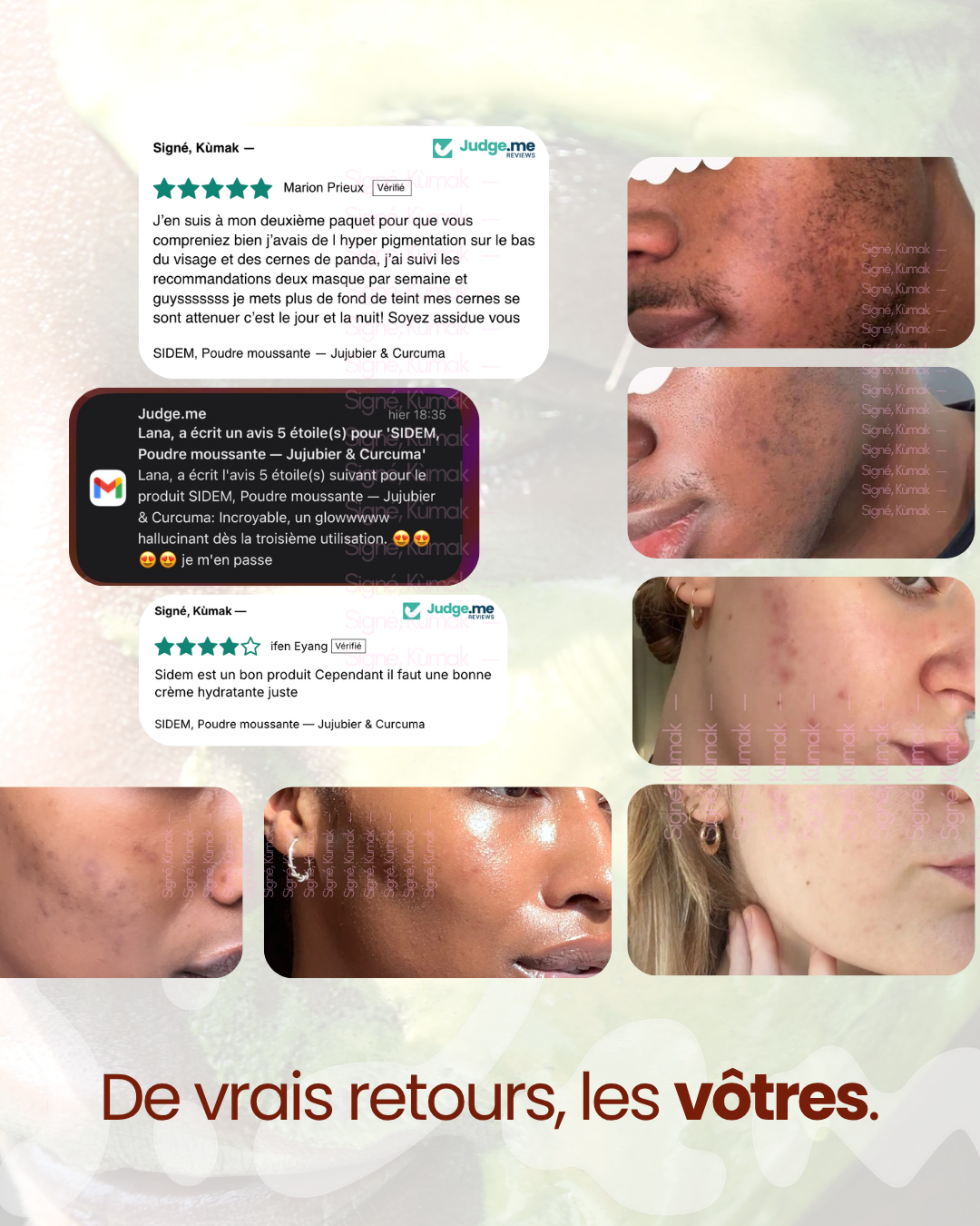 Avis de clientes SIDEM et photos de peaux sans retouche