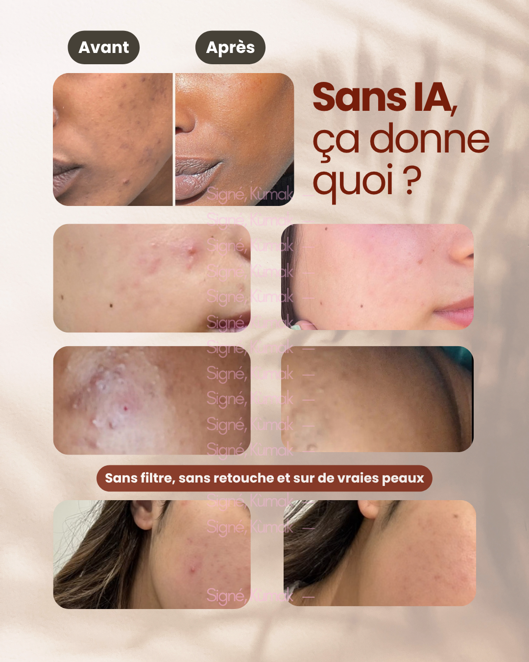 Avant et après : peaux de clientes SIDEM photographiées sans filtre